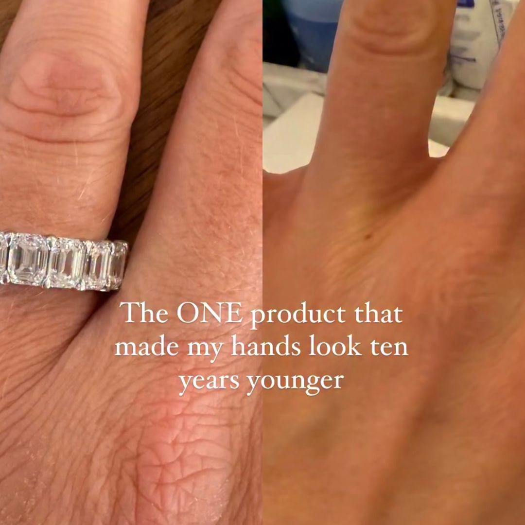 Influencer reveals the one product that made her hands look 10 years younger
